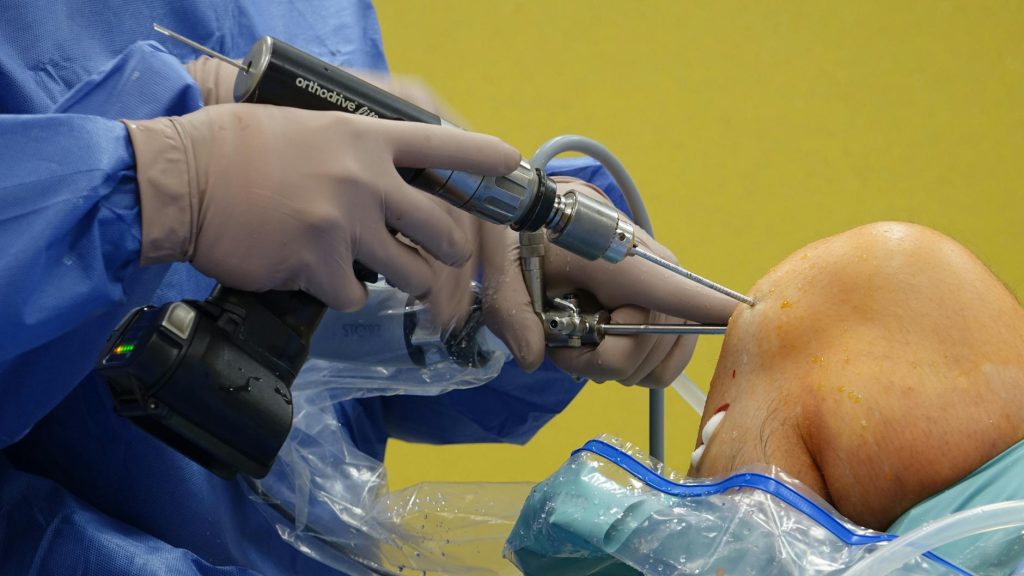 orthopedic surgeon performing knee arthroscopy